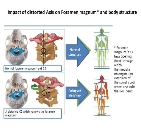 foramen magnum